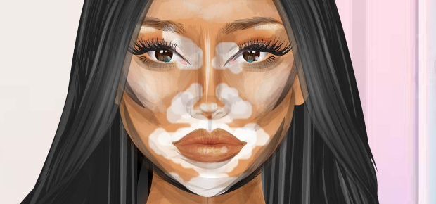 Celebridade de Sexta! -> Winnie Harlow